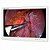 Monitor Médico Cirúrgico Reshin MS270P 27" Full HD para Endoscopia e Videocirurgia - Imagem 1