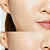 Adesivo Hidrocoloide COSRX Acne Pimple Master Patch (24 Adesivos) - Imagem 4