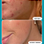 Tônico Esfoliante Paula´s Choice Skin Perfecting Jumbo Size 2% BHA Liquid Exfoliant 236ml - Imagem 2