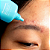 Secativo para Acne Starface Star Treatment - Imagem 2