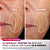Máscara Facial de LED Shark Beauty CryoGlow Red Blue & Infrared iQLED Face Mask & Under Eye Cooling | Cosmic Violet - Imagem 4