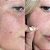 Adesivos Hidrocolóides Personal Day All Covered Brushed Blemish Patches | 30 adesivos - Imagem 3