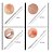 Kit Extrator de Cravos 4 Curetas Rose Gold - Imagem 3