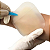 Curativo Hidrocoloide Regular Casex - Imagem 2