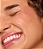 Blindagem Fix Tudo Dailus - Imagem 2