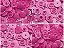 Botão Pressão Plástico 15 Rosa Choque - 20 unidades - Imagem 1