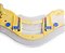 COLAR CERVICAL PERFIT ACE INFANTIL - Imagem 4