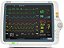 Locação Monitor Multiparametrico Mindray Umec 12 - Imagem 1
