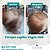 TERAPIA CAPILAR - VEGAN HAIR - Calvície, Queda, Caspa, Dermatite - Imagem 3