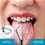 Kit 3 Instrumentos Limpeza Dental Tártaro +1 Raspador Língua - Imagem 6