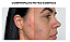 BioBio Bastão Facial Antimarcas 11g - Imagem 7