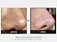 Sérum Facial Regenerador One Day Exossoma Shot 7500 Medicube - 30ml - Imagem 2