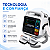 MONITOR CARDIOVERSOR DESFIBRILADOR I6 4 em 1 - AMOUL - Imagem 3