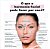 Preenchedor Facial e Corporal Ácido Hialurônico Injetável Reticulado SUBSKIN LIDO 10 ml - Loyoderm - Imagem 7