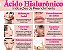 Preenchedor 2ml Ácido Hialurônico Injetável Reticulado Derm Lido + Microcânula de Brinde - Loyoderm - Imagem 6