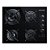 Cooktop 4 Bocas Brastemp com Duplachama e Timer Touch - BDT62AE - Imagem 2