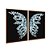Kit Dois Quadros Decorativos Borboleta de Cristal Azul Fundo Preto - Imagem 6