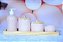 Kit Higiene Porcelana Poa Tampa e Bandeja Madeira - Imagem 6