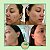 Kit Pele com Acne e Manchas - Imagem 4