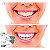 Creme Dental Branqueador Progressivo Kin Whitening 95g - Imagem 4