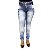 Calça Jeans Feminina Manchada Helix com Lycra - Imagem 1