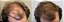 Crescimento Barba e Cabelo - 6 Frascos p 6 Meses - Com Aplicador - Caixa Lacrada - Minoxidil Kirkland - Imagem 4
