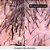 Shampoo Loreal Scalp Advanced Anti-Pelliculaire Dandruff - 300ml - Imagem 4