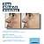 Anti Melasma Polypodium Leucotomos 300mg + Picnogenol 250mg 30 Capsulas - Imagem 3