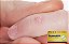 DERMAFREE  15ML DELTA - Imagem 3