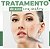 Curso de Tratamento de Acne com Ácidos - Imagem 1