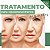 Curso de Tratamento para Rejuvenescimento com Ácidos - Imagem 1