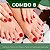 Curso de Manicure, Pedicure e Plástica Podal com Aplicação de Ácidos Combo 08 - Imagem 1