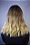 WIG ELISA - Imagem 4
