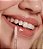 Lip Gloss - Dailus - Imagem 2