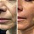 Collagen C-Pure ENDOGEN - Imagem 2