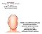 Faixa Mandibular Anti Ronco Preta Kestal - Imagem 4