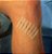 Curativo Skin-Strip Ponto Falso com 12 Tiras Skinupper - Imagem 3