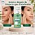 Gel de Limpeza Facial Dermatológico Acnelizy 500ml Vitalizy - Imagem 6