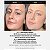 Red Acne Succinic Acid Peel Medicube 40g - Imagem 2