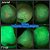 TW Cyan laser azul de Alta Potência Odontologia MMO - Imagem 4