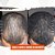 Kit Shampoo + Minox Fortalecedor Loção Para Crescimento Cabelo e Barba - Imagem 3