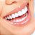 Sorriso Gengival - Imagem 1