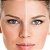 Skinbooster - Imagem 1