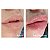 Renove Lips Preenchedor Labial - 5g - Imagem 3