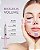 Preenchedor de Ácido Hialurônico Biogelis® Volume com Lidocaína – Pharmaesthetics - Imagem 3