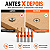 Kit 5 Brocas Escareadoras 8mm Para Madeira MDF Rebaixo Parafuso Furadeira Parafusadeira - Imagem 5