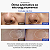 Ampola Medicube One Day Exosome Shot 2000 30ml - Imagem 4