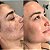 Creme clareador de manchas na pele cicatridiva 250g - Imagem 5