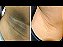 Creme clareador de manchas na pele cicatridiva 250g - Imagem 2