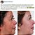 2 x Frasco Creme clareador de manchas na pele cicatridiva 250g - Imagem 3